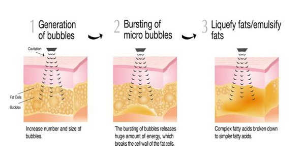 Cavitation Process